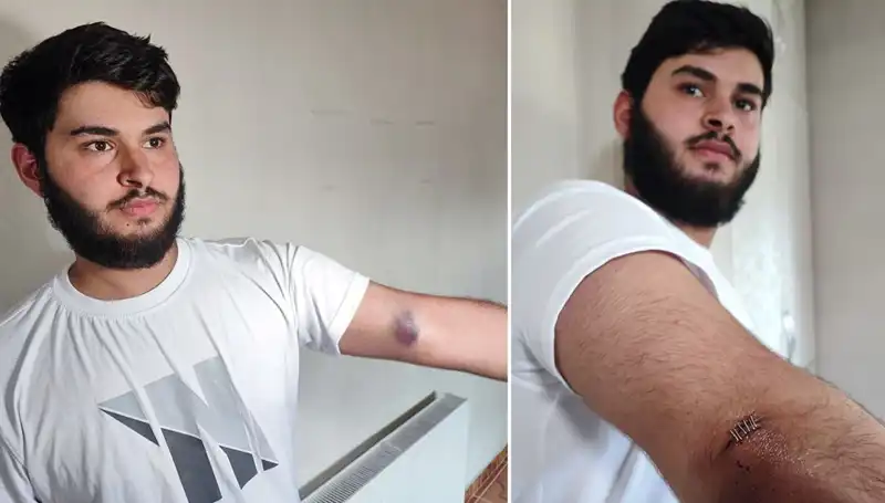 Bahçeye Kaçan Top, Mahallede Gözler Mola Verdi: Conoların Kamyonetiyle Gelen Kaos