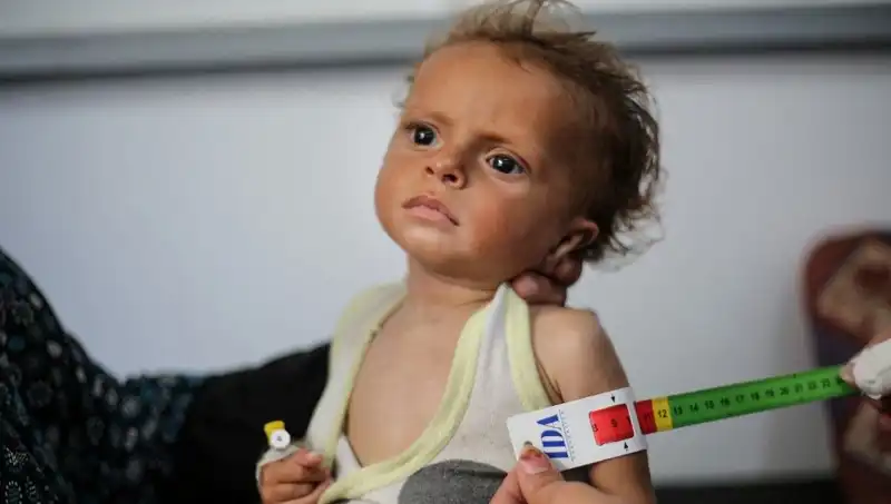 İngiltere, Gazze'deki 300 Çocuğa Yeni Bir Umut Sunacak